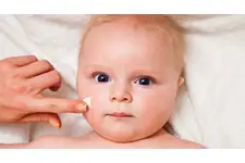 Bebeklerde Sedef Hastalığı Belirtileri ve Tedavisi